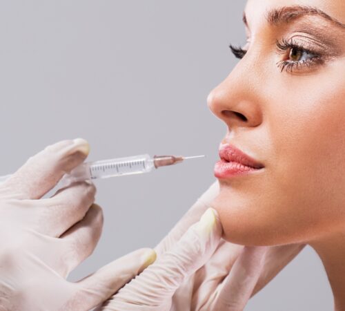 A-lip-filler-practitioner-is-about-to-inject-a-young-woman-with-dermal-filler.-