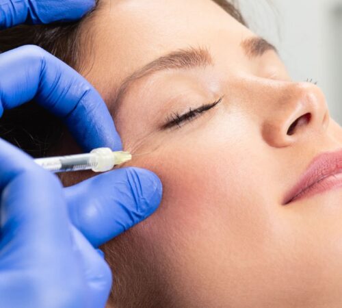 Botox-Injection-Sites-1-scaled-fotor-2023111920191